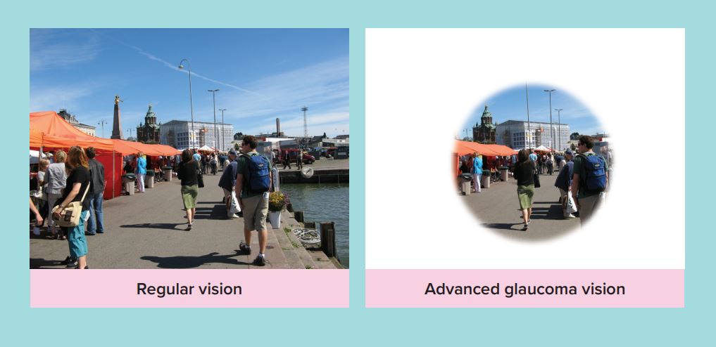 A picture of an outdoor boardwalk and people with the caption "regular vision". The same image is duplicated so that the outsides are obscured and only an inner circle is visible. Caption reads "advanced glaucoma vision"