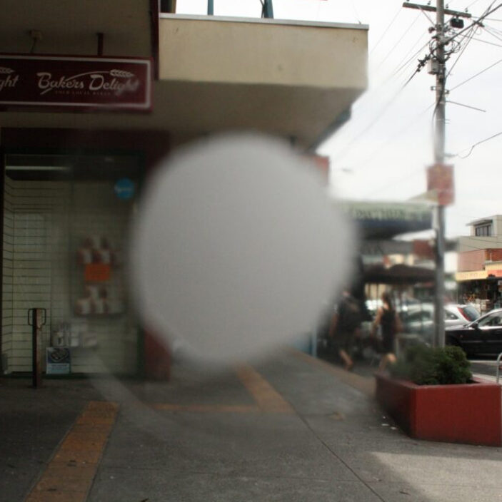 Common causes of vision loss. Guide Dogs SA/NT